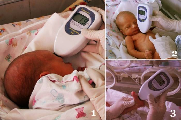 Измерение билирубина у новорожденных